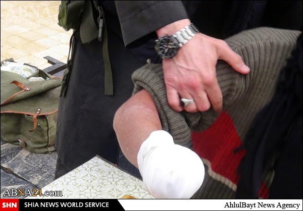 قطع کردن دست جوان سوری توسط داعش جنایتی برخلاف سنت اسلام  +تصویر