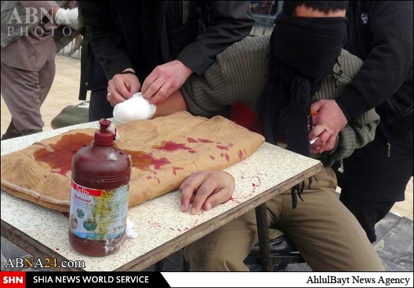 قطع کردن دست جوان سوری توسط داعش جنایتی برخلاف سنت اسلام  +تصویر