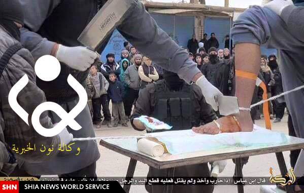 تصویر/داعش، پای عناصر فراری‌اش از جنگ را قطع می‌کند