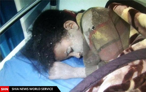 کودک کشی عربستان در یمن+تصاویر
