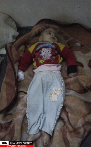 شهادت یک کودک سوری در الفوعه ادلب+ تصویر