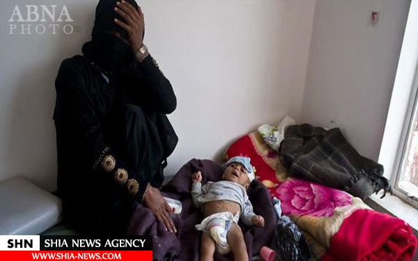 کودکان یمنی رو در رو با مرگ + تصاویر