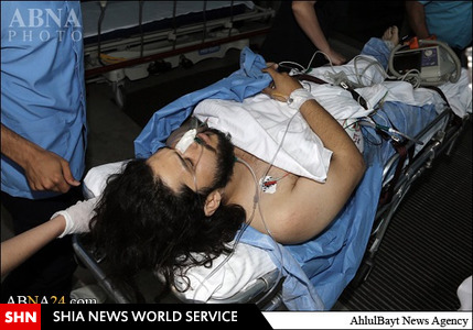 زخمی‎شدن خبرنگار رویترز در حلب/تصاویر