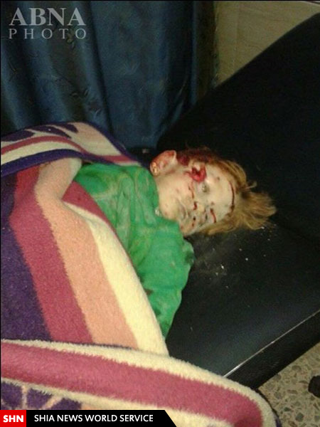 شهادت دو کودک شیعه سوری در حمله موشکی گروه های تکفیری به شهر الزهرا+ تصاویر