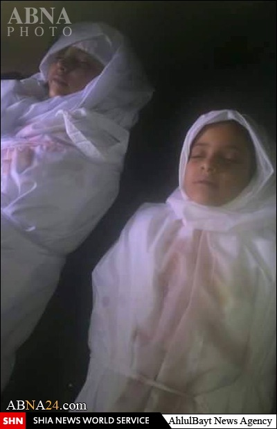 کودکان یمنی؛ قربانیان جنایت جدید رژیم سعودی در شهر «تعز» + تصاویر
