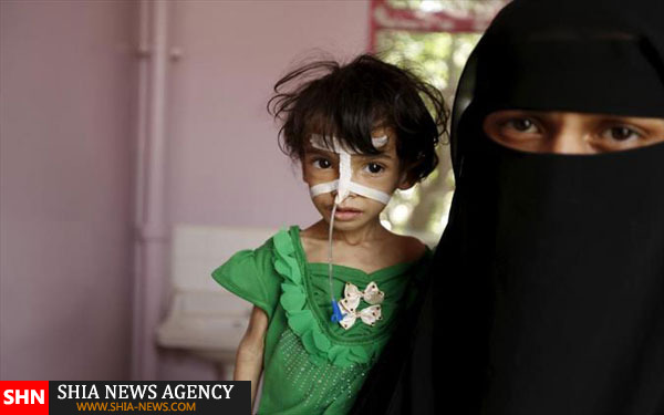 تصاویر دلخراش از کودکان قحطی زده یمن