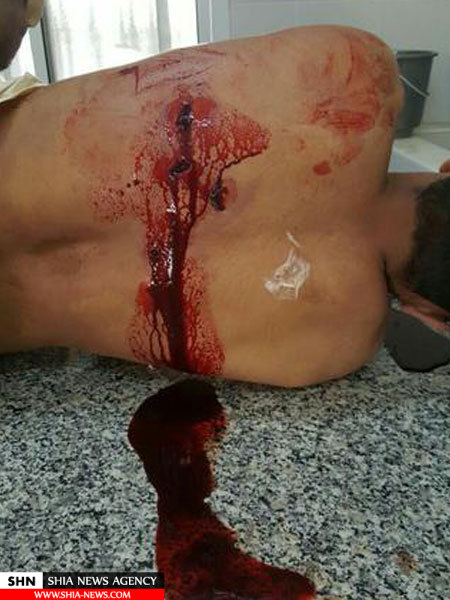 تصویری غم انگیز از پیکر شهید بحرینی در غسالخانه 18+