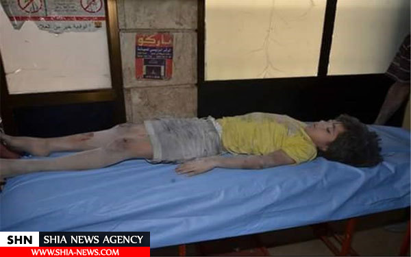 تصاویر کودکان حلب قربانیان حملات تروریست‌ها