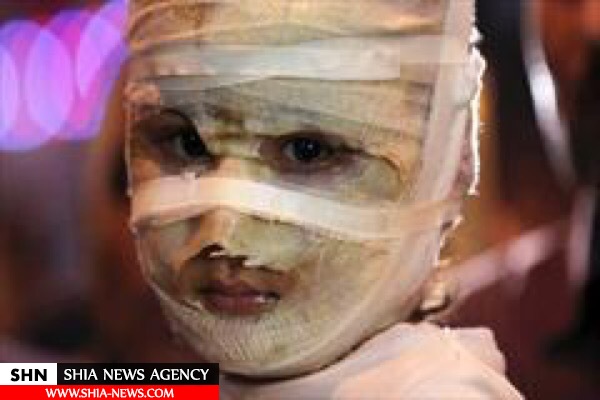 تصویر دلخراش دختر ۴ ساله عراقی دنیا را تکان داد