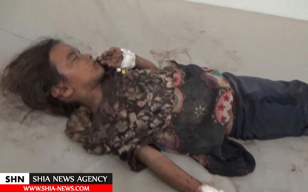 جنایت جدید عربستان در روستای الخواریه در یمن+ تصاویر