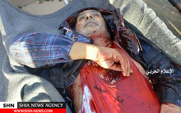 تصاویر جنایت تروریست ها علیه شیعیان