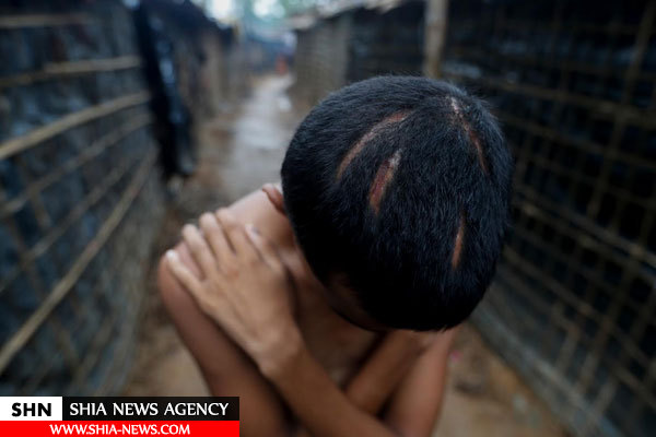 تصاویر بهت‌آور رویترز از آثار گلوله و سوختگی روی تن غیرنظامیان روهینگیا