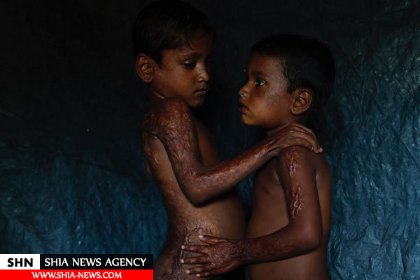تصاویر بهت‌آور رویترز از آثار گلوله و سوختگی روی تن غیرنظامیان روهینگیا
