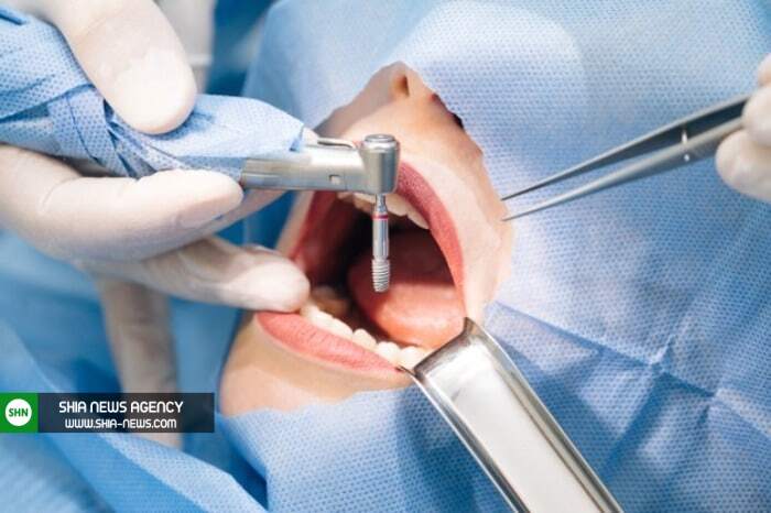 علت تریسموس؛ مشکل دردناک دندانی