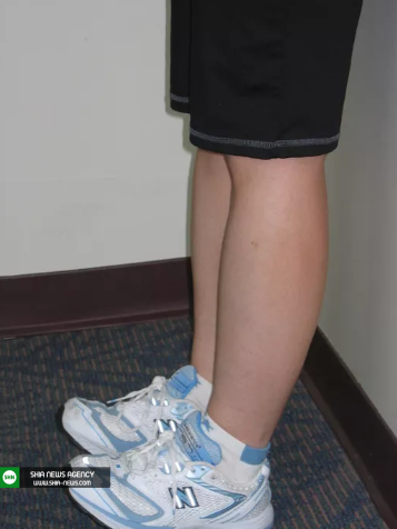 حرکات ورزشی برای تقویت مچ پا و کمک به درمان آرتروز مچ پا