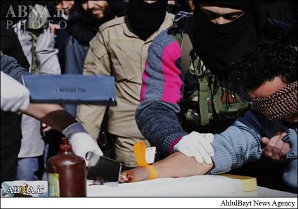 تصویـــــر - داعش دست یک عضو خود را قطع کرد (۱۸+)