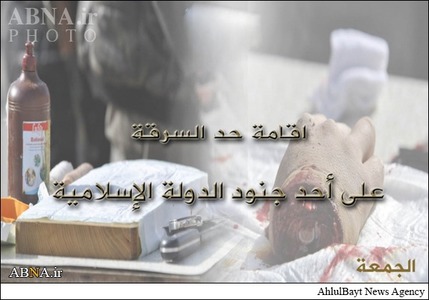 تصویـــــر - داعش دست یک عضو خود را قطع کرد (۱۸+)