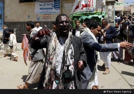 انتقال زخمی های یمنی به تهران