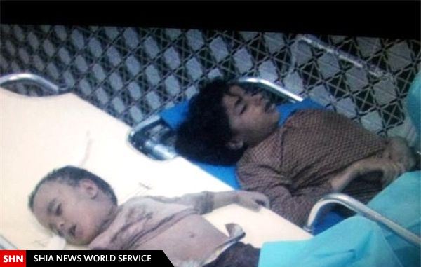 کودک کشی عربستان در یمن+تصاویر