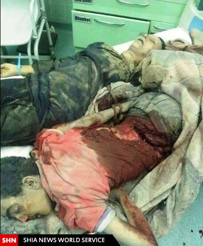 کودک کشی عربستان در یمن+تصاویر