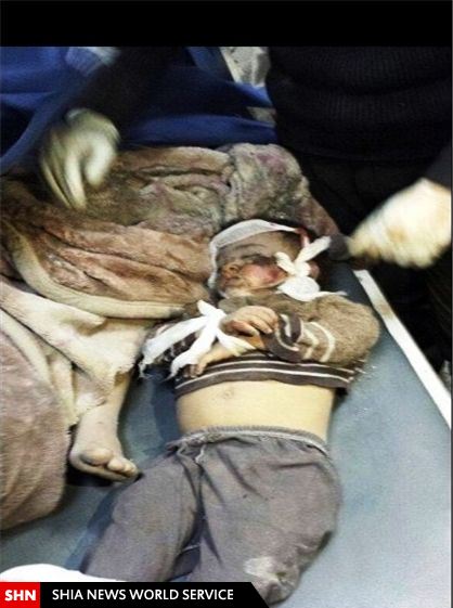 کودک کشی عربستان در یمن+تصاویر