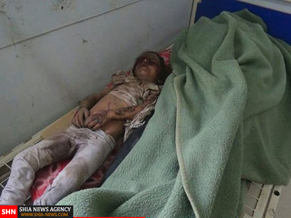 تصاویر آخرین جنایت عربستان در یمن