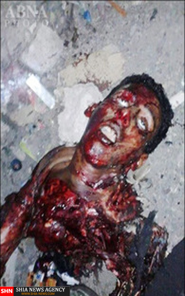 انفجار پیش از موعد یک داعشی در یمن+عکس(18+)