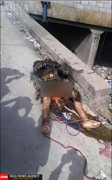 تکفیری‌ها شهروندیمنی را آتش زدند + تصویر