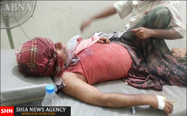 جنایت فجیع رژیم سعودی در تعز یمن +تصاویر
