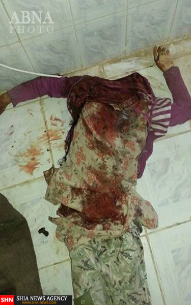 جنایت فجیع رژیم سعودی در استان اب یمن + تصاویر (18+)