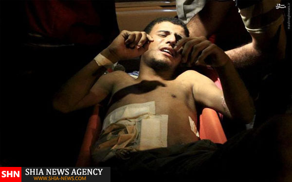 جدیدترین تصاویر از جنگ در یمن