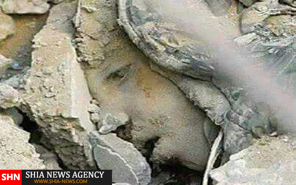 تصویری دلخراش از کودک دفن‌شده به دست سعودی‌ها