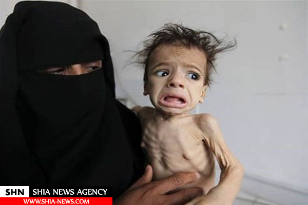 نگاهی به ابعاد جنایت‎های عربستان در یمن