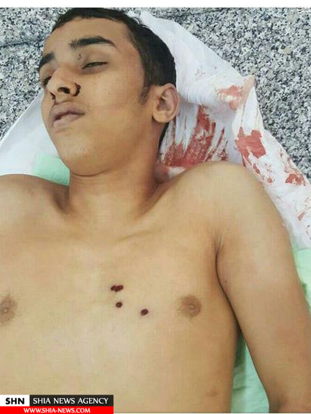 تصویری غم انگیز از پیکر شهید بحرینی در غسالخانه 18+ تصویری غم انگیز از پیکر شهید بحرینی در غسالخانه 18+