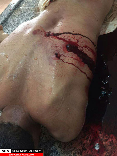تصویری غم انگیز از پیکر شهید بحرینی در غسالخانه 18+ تصویری غم انگیز از پیکر شهید بحرینی در غسالخانه 18+