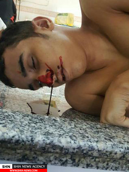 تصویری غم انگیز از پیکر شهید بحرینی در غسالخانه 18+ تصویری غم انگیز از پیکر شهید بحرینی در غسالخانه 18+