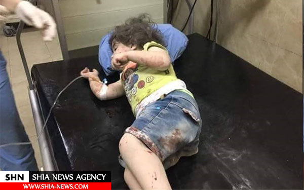 تصاویر کودکان حلب قربانیان حملات تروریست‌ها