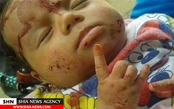 تصاویر کودکان حلب قربانیان حملات تروریست‌ها