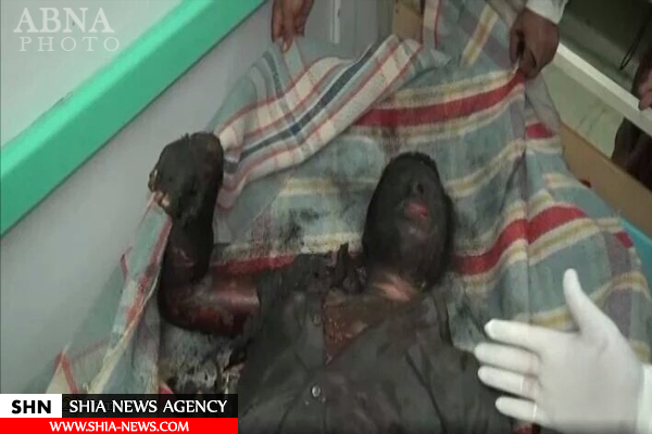 حمله وحشیانه رژیم سعودی به روستای العذاری+ تصاویر