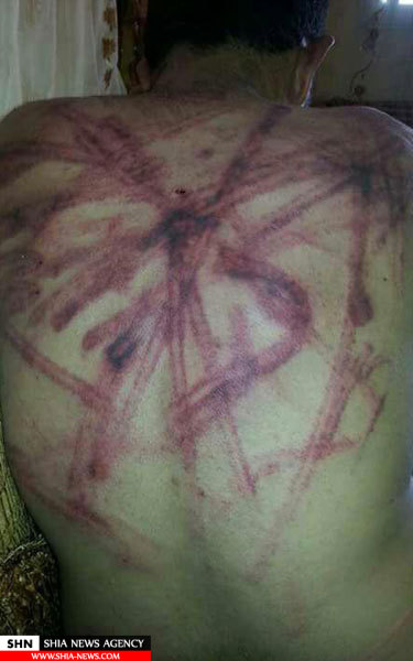 شکنجه جوانان سوری توسط معارضان میانه روی دولت!
