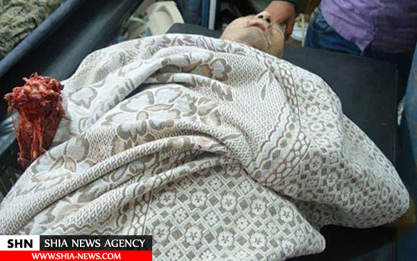 تصاویر جنایت تروریست ها علیه شیعیان