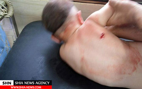 تصاویر جنایت تروریست ها علیه شیعیان