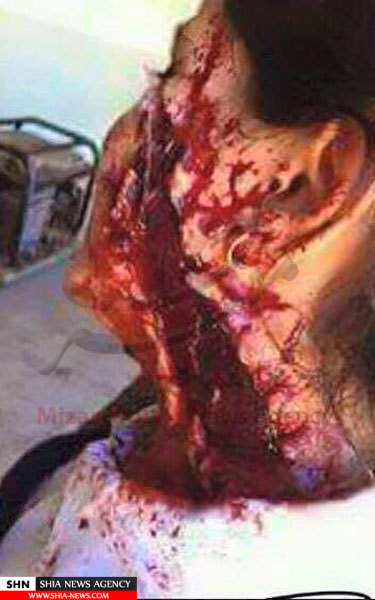 انتشار تصاویر جنجالی از گریم کردن قربانیان جنایات اسد