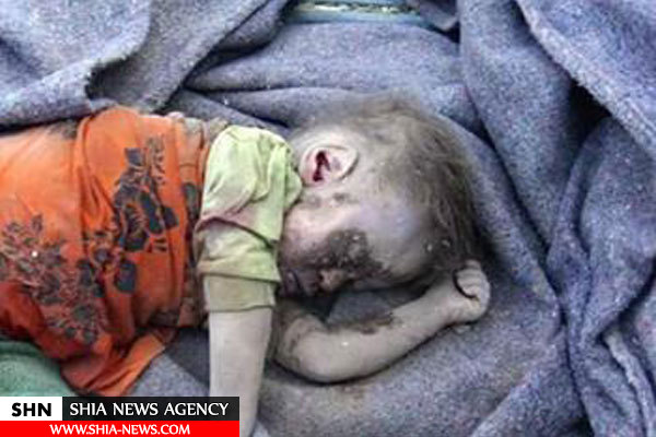 تصاویر کودکان یمن زیر آتش جنگنده های سعودی