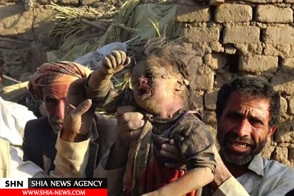 تصاویر کودکان یمن زیر آتش جنگنده های سعودی