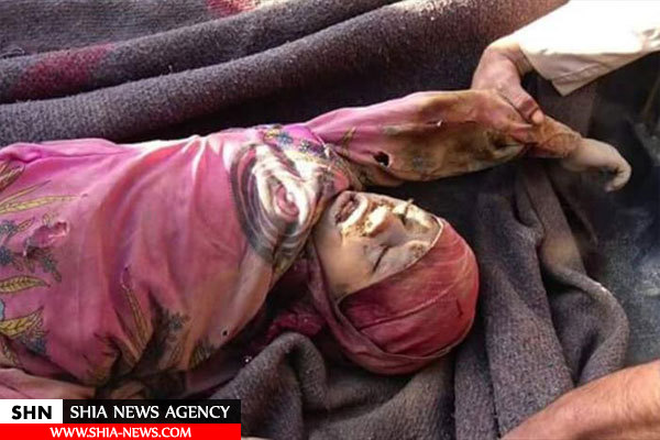 تصاویر کودکان یمن زیر آتش جنگنده های سعودی