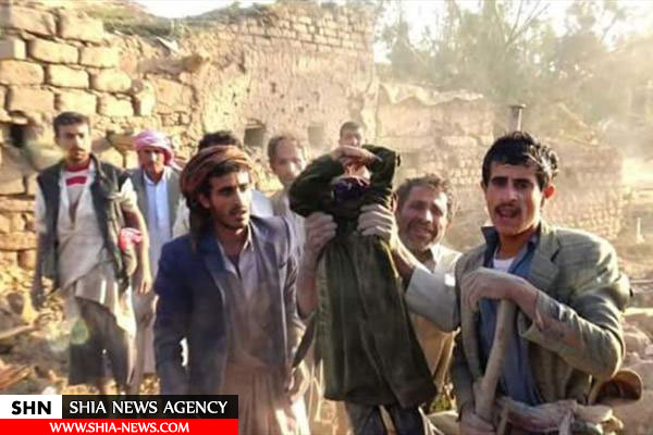 تصاویر کودکان یمن زیر آتش جنگنده های سعودی