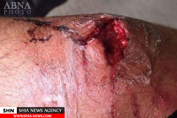 انداختن سگ‌ به جان مهاجران+ تصاویر