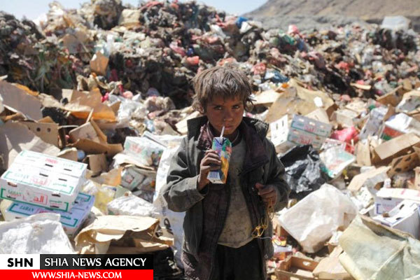 تصویر زندگی تلخ کودک یمنی