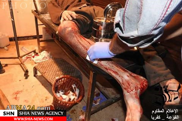 زخمی شدن ۲۲ شیعه در حمله خمپاره ای به فوعه و کفریا
